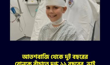 আতশবাজি থেকে দুই বছরের বোনকে বাঁচাতে দগ্ধ ১১ বছরের  ভাই